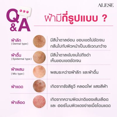 Alese Dark Spot ครีมทาฝ้า